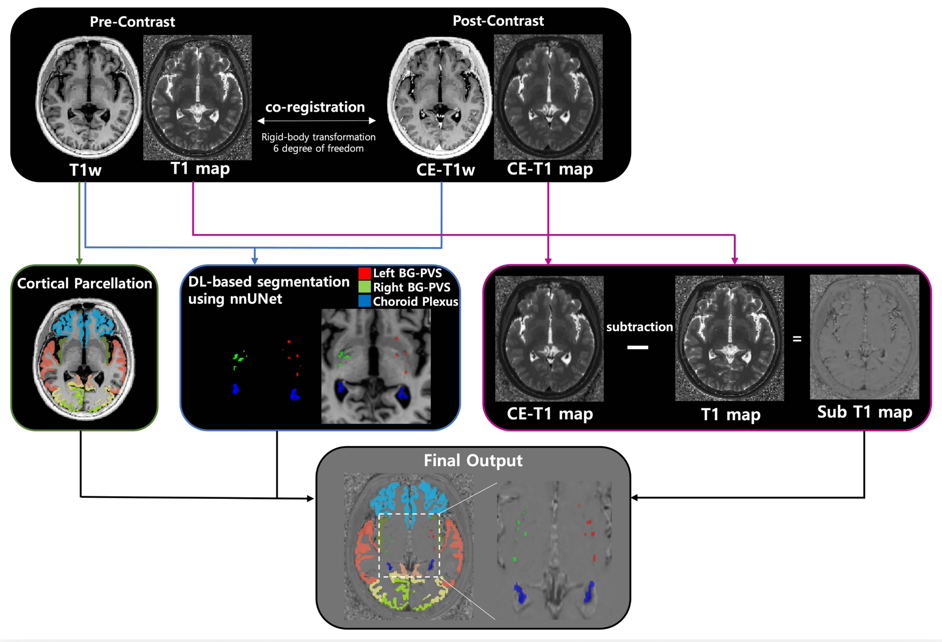 Infant LV and CP segmentation