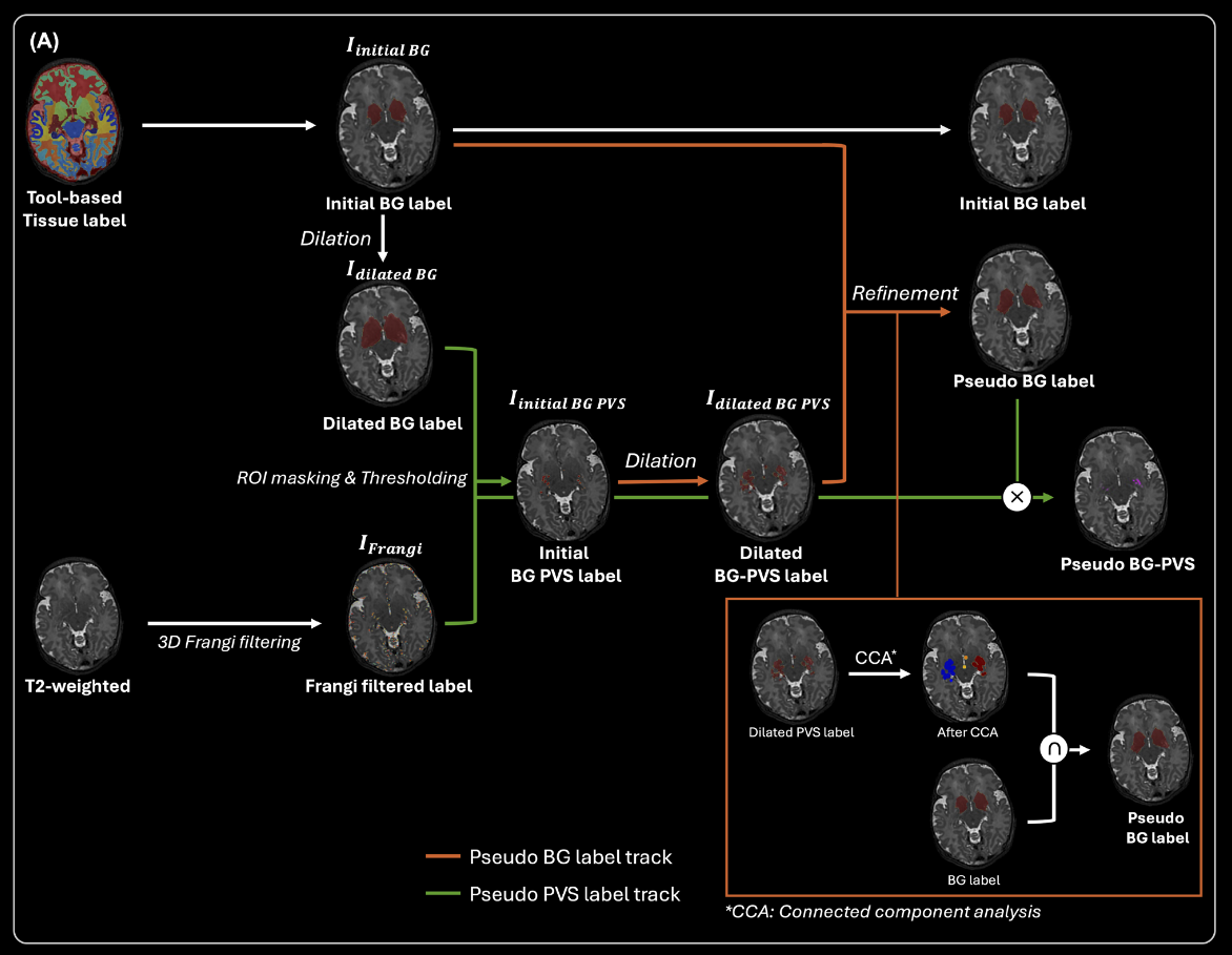 Labeling of BG/BG-PVS