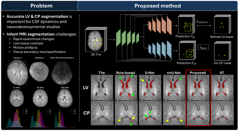 Infant LV and CP segmentation